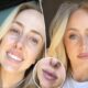 Brittany Mahomes Reveals She's 'Really Struggling' with Acne Breakout in New Makeup-Free Selfies