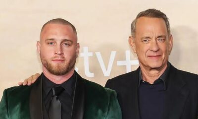 Tom Hanks’ Son Chet Hanks Got His Forehead 'Blasted With Botox' Tom Hanks’ son Chet Hanks showed off his newly ‘blasted’ forehead after Botox treatment